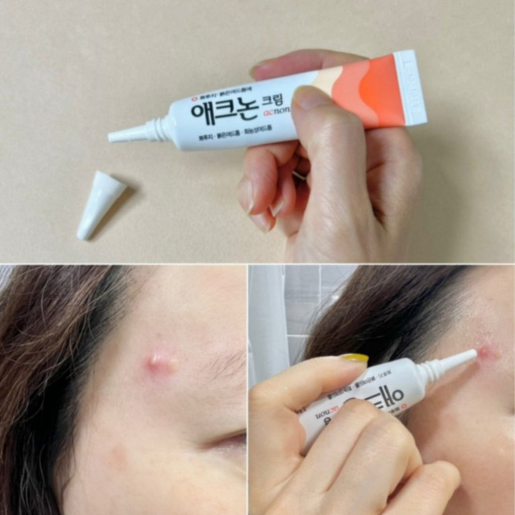 DONG-A Acnon Cream 13g Acne Care Treatment Pimples, Purulent Acne, No Antibiotics, No Steroids, Direct shipping from Seoul to Singapore